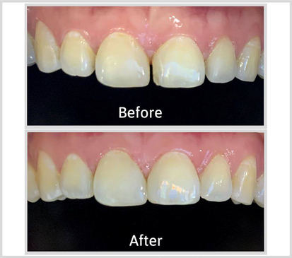 Slider image (7) Home Dental Clinic